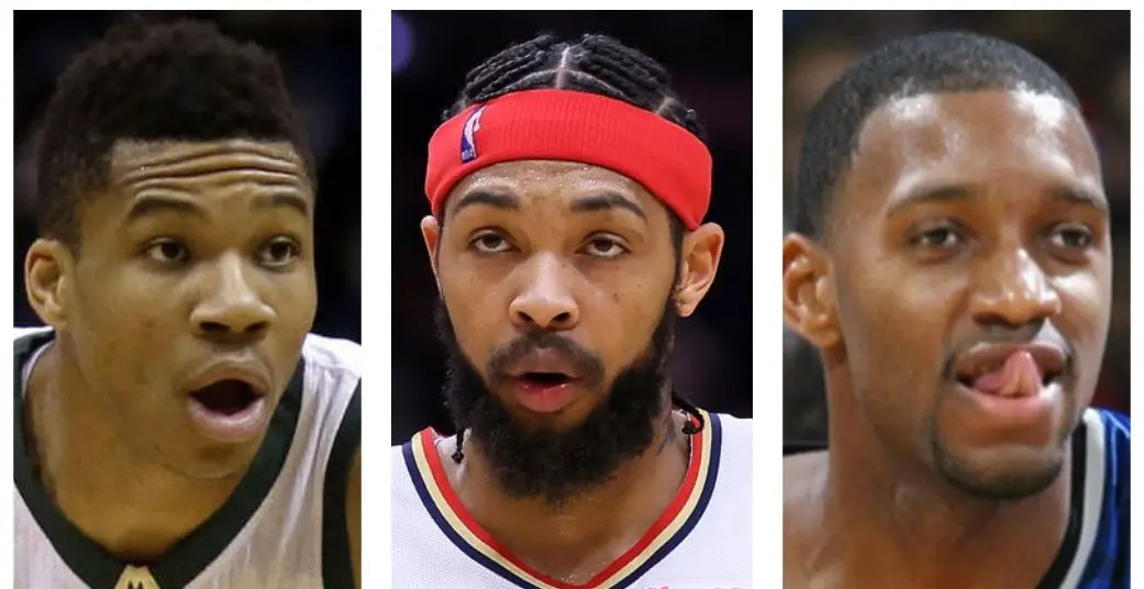 10 Best NBA Most Improved Player Awardees